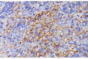 Immunohistochemistry of paraffin-embedded Rat lymph node using SNAP23 Polyclonal Antibody at dilution of 1:100 (40x lens). (SNAP23 anticorps)