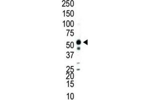 Western blot analysis of JNK2 antibody and Jurkat cell lysate.
