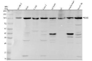 Western blot analysis of PSD93 using anti-PSD93 antibody (ABIN7602953).