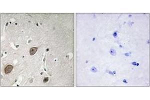 Immunohistochemistry (IHC) image for anti-Brain-Enriched Guanylate Kinase-Associated (BEGAIN) (AA 511-560) antibody (ABIN2889742) (BEGAIN anticorps  (AA 511-560))