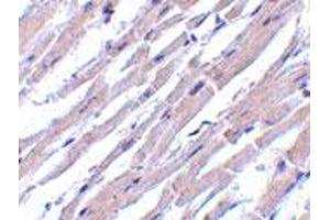 Immunohistochemistry of BCL2L13 in human heart tissue with BCL2L13 polyclonal antibody  at 10 ug/mL . (BCL2L13 anticorps  (Internal Region))