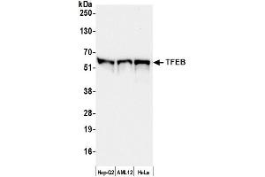 Western Blotting (WB) image for anti-Transcription Factor EB (TFEB) (AA 426-476) antibody (ABIN7450814) (TFEB anticorps  (AA 426-476))