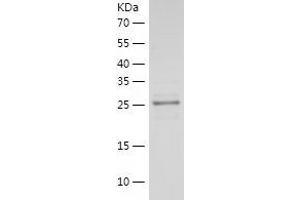 Western Blotting (WB) image for Laminin, alpha 5 (LAMA5) (AA 3401-3692) protein (His-IF2DI Tag) (ABIN7123713)