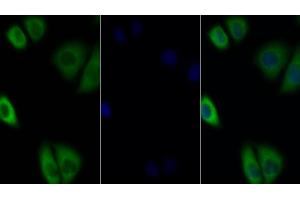 Detection of IL27Ra in Human MCF7 cell using Polyclonal Antibody to Interleukin 27 Receptor Alpha (IL27Ra) (IL27 Receptor alpha anticorps  (AA 93-273))