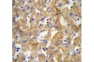 Immunohistochemistry analysis in human liver tissue (Formalin-fixed, Paraffin-embedded) using SPACA5 Antibody , followed by peroxidase conjugation of the secondary antibody and DAB staining. (SPACA5 anticorps  (Middle Region))
