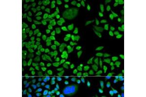Immunofluorescence analysis of HeLa cells using TIA1 Polyclonal Antibody (TIA1 anticorps)