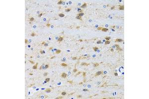 Immunohistochemistry of paraffin-embedded mouse brain using MAPK9 antibody (ABIN5970592) at dilution of 1/100 (40x lens). (JNK2 anticorps)