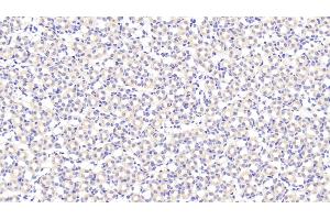Detection of BGN in Mouse Kidney Tissue using Polyclonal Antibody to Biglycan (BGN)