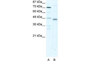 WB Suggested Anti-ZFP1 Antibody Titration:  2. (Zfp-1 anticorps  (N-Term))