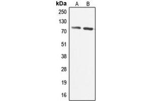 Western blot analysis of CABC1 expression in HeLa (A), U251MG (B) whole cell lysates.