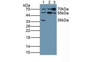 Western blot analysis of (1) Human Liver Tissue, (2) Human HeLa cells and (3) Rat Serum. (Butyrylcholinesterase anticorps  (AA 29-150))