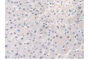 Detection of STX1A in Human Liver Tissue using Polyclonal Antibody to Syntaxin 1A, Brain (STX1A) (STX1A anticorps  (AA 1-255))