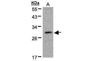WB Image Sample(30 μg of whole cell lysate) A:MOLT4, 12% SDS PAGE antibody diluted at 1:500 (Kallikrein 2 anticorps)