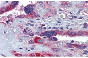 Immunohistochemistry with Human Placenta lysate tissue at an antibody concentration of 5. (GTPBP10 anticorps  (Middle Region))