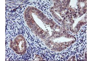 Image no. 3 for anti-1-Acylglycerol-3-Phosphate O-Acyltransferase 5 (Lysophosphatidic Acid Acyltransferase, Epsilon) (AGPAT5) antibody (ABIN1496497)