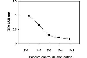 Jurkat cells were treated with Pervanadate. (Phospholipase C gamma 1 Kit ELISA)