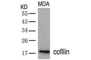 Western blot analysis of extracts from MDA cells using cofilin(Ab-3) Antibody. (Cofilin anticorps  (AA 1-5))