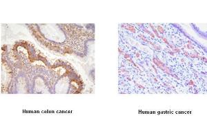 Immunohistochemistry (IHC) image for anti-EPH Receptor A2 (EPHA2) (AA 559-976) antibody (ABIN317512) (EPH Receptor A2 anticorps  (AA 559-976))