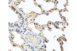 Immunohistochemistry of paraffin-embedded Rat lung using PIP Polyclonal Antibody at dilution of 1:100 (40x lens). (PIP anticorps)