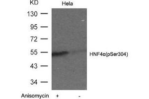 Western blot analysis of extracts from Hela cells untreated or treated with Anisomyclin using HNF4a(Phospho-Ser304) Antibody. (HNF4A anticorps  (pSer304))
