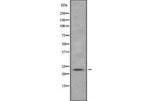 Western blot analysis of MYL4 using HeLa whole cell lysates (MYL4 anticorps  (N-Term))