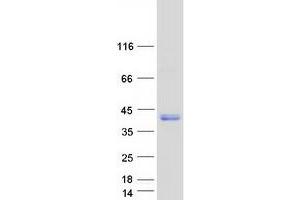 Validation with Western Blot