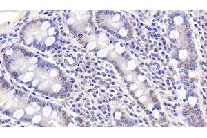 Detection of ASPH in Human Small intestine Tissue using Polyclonal Antibody to Aspartate Beta Hydroxylase (ASPH)