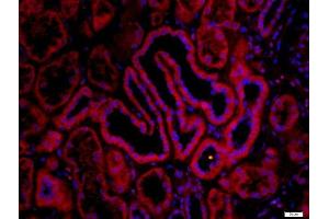 Paraformaldehyde-fixed, paraffin embedded human kidney, Antigen retrieval by boiling in sodium citrate buffer (pH6) for 15min, Block endogenous peroxidase by 3% hydrogen peroxide for 30 minutes, Blocking buffer (normal goat serum) at 37°C for 20min, Antibody incubation with CHRNA7 Polyclonal Antibody, Unconjugated  at 1:200 overnight at 4°C, followed by a conjugated secondary Goat Anti-Rabbit IgG, Cy3 conjugated-Cy3)used at 1:200 dilution for 40 minutes at 37°C.