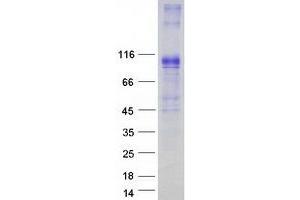 Validation with Western Blot
