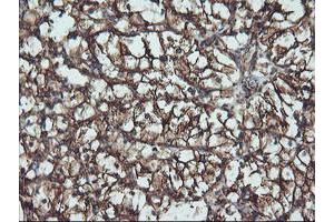 Immunohistochemical staining of paraffin-embedded Human Kidney tissue using anti-ATG3 mouse monoclonal antibody. (ATG3 anticorps)