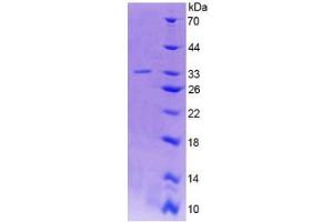 SDS-PAGE analysis of Human GAD2 Protein. (GAD65 Protéine)