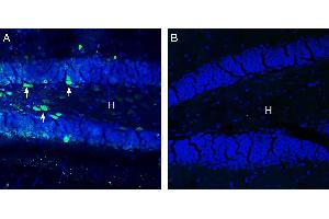Expression of GABA(A) π Receptor in mouse hippocampus.