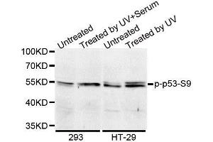 Western blot analysis of extracts of 293 cell lines, using Phospho-TP53-S9 antibody.