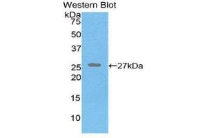 Western Blotting (WB) image for anti-Elastin (ELN) (AA 392-645) antibody (ABIN1174510) (Elastin anticorps  (AA 392-645))
