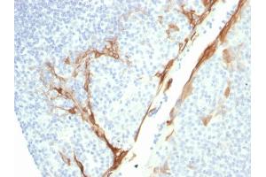 Formalin-fixed, paraffin-embedded human Tonsil stained with CK16 Mouse Recombinant Monoclonal Antibody (rKRT16/1714). (Recombinant KRT16 anticorps  (C-Term))