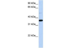 LTB4DH antibody used at 1 ug/ml to detect target protein. (PTGR1 anticorps  (N-Term))