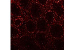 IF analysis of CTBP2 using anti-CTBP2 antibody (ABIN7601326). (CTBP2 anticorps  (AA 321-445))