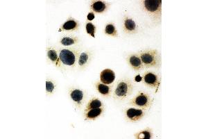 Anti-Egr1 antibody, ICC ICC: MCF-7 Cell (EGR1 anticorps  (N-Term))