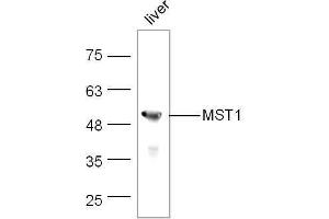 Mouse liver lysates probed with Rabbit Anti-MST1 Polyclonal Antibody, Unconjugated  at 1:500 for 90 min at 37˚C.