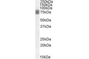 Image no. 1 for anti-NUAK Family, SNF1-Like Kinase, 1 (NUAK1) (Internal Region) antibody (ABIN375083) (NUAK1 anticorps  (Internal Region))