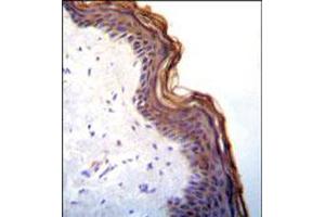 Immunohistochemical staining of formalin fixed and paraffin embedded human skin was performed with KLK7 polyclonal antibody  at 1:10-1:50 dilution followed by indirect peroxidase conjugation with secondary antibody and DAB staining. (Kallikrein 7 anticorps  (C-Term))