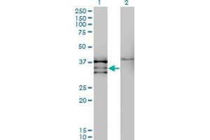 Western Blot analysis of NKX2-5 expression in transfected 293T cell line by NKX2-5 monoclonal antibody (M08), clone 3E3. (NK2 Homeobox 5 anticorps  (AA 1-130))
