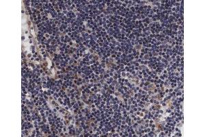 ABIN6267393 at 1/200 staining human lymph node tissue sections by IHC-P.