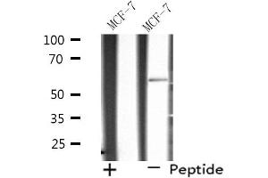 Western blot analysis of extracts from MCF-7 cells using SHC2 antibody.