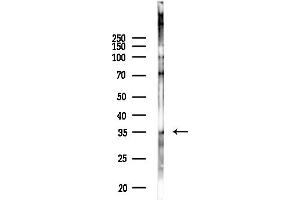 anti-GTPase, IMAP Family Member 5 (GIMAP5) (Internal Region) antibody