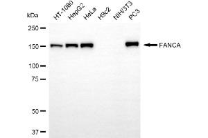 Western blotting analysis using FANCA antibody (ABIN7798563).