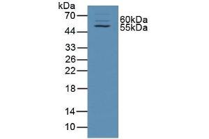 Figure. (alpha Taxilin anticorps  (AA 1-234))