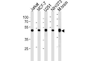 Western blot analysis in Jurkat,MCF-7,U251,mouse NIH/3T3 cell line and mouse brain tissue lysates (35ug/lane).