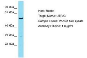 Image no. 1 for anti-UTP23, Small Subunit (SSU) Processome Component, Homolog (UTP23) (AA 151-200) antibody (ABIN6750446) (UTP23 anticorps  (AA 151-200))
