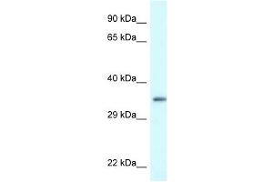 Western Blot showing PDLIM1 antibody used at a concentration of 1 ug/ml against Hela Cell Lysate (PDLIM1 anticorps  (C-Term))